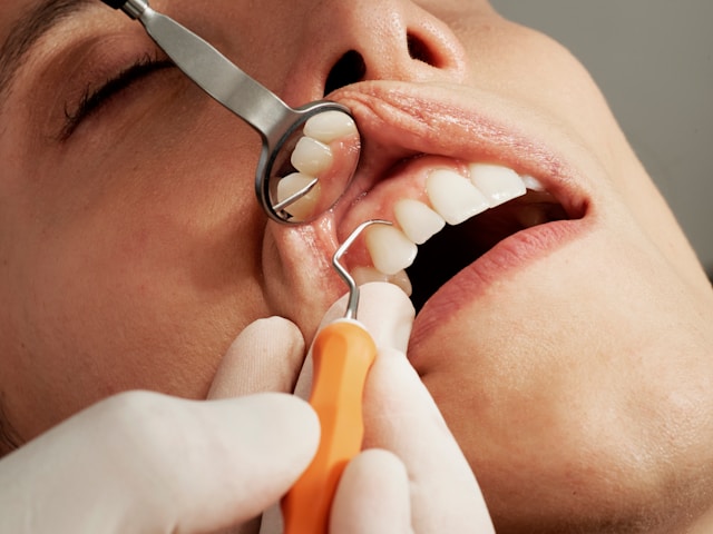 Cuándo un absceso dental se convierte en una urgencia médica